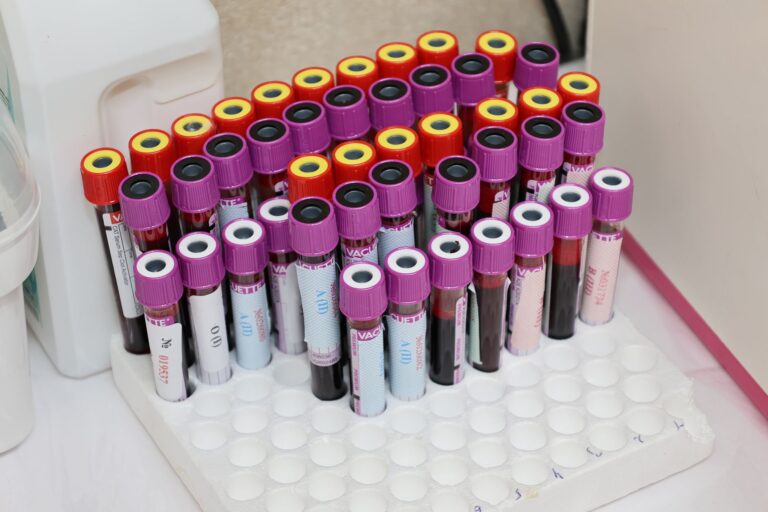 Blutproben im Labor – Blutgruppen-Bestimmung