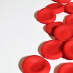 Sichelzellanämie – verformte rote Blutkörperchen und Hämoglobin S
